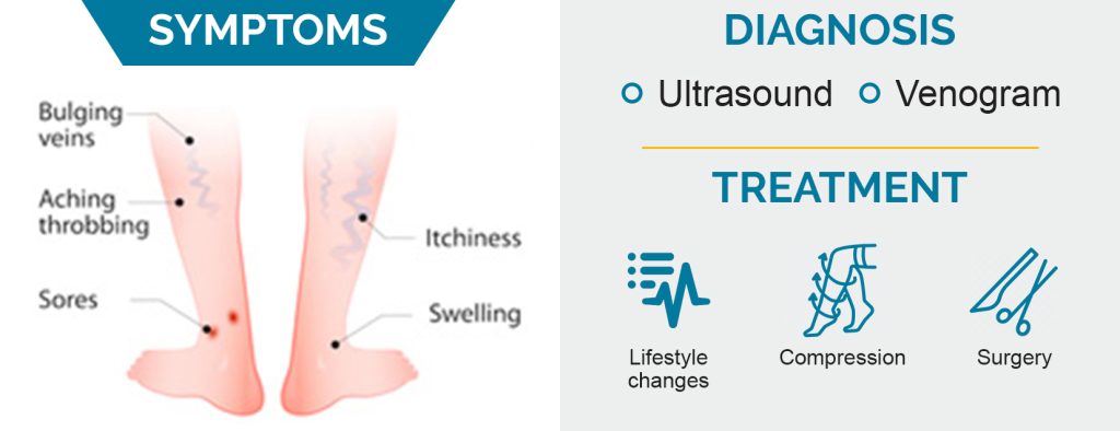 Symtoms & Diagnosis of Varicose Veins - Star Magic Healing
